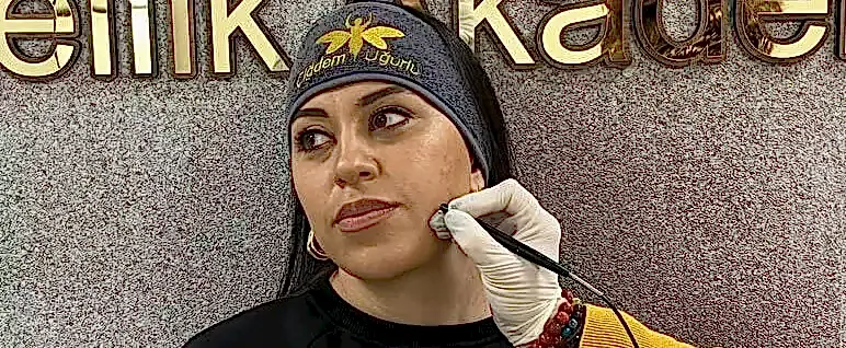 İğneli Epilasyon Eğitimi